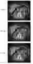 Fig. 09 - Reducing noise in an image