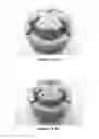 Fig. 11 - Super-Hard Enhanced Hard Metals