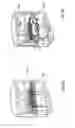 Fig. 04 - Apparatus for sanitizing oral appliances