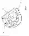 Fig. 05 - Apparatus for sanitizing oral appliances