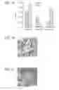 Fig. 02 - CANCER STEM CELL EXPRESSION PATTERNS AND COMPOUNDS TO TARGET CANCER STEM CELLS