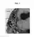Fig. 08 - Methods and compositions for imaging cancer cells