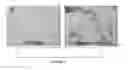 Fig. 03 - ELASTIN FOR SOFT TISSUE AUGMENTATION
