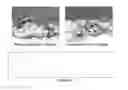Fig. 05 - ELASTIN FOR SOFT TISSUE AUGMENTATION