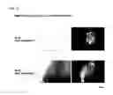 Fig. 08 - RECOMBINANT NEWCASTLE DISEASE VIRUS
