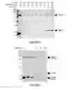 Fig. 35 - METHODS FOR TREATING CONDITIONS ASSOCIATED WITH MASP-2 DEPENDENT COMPLEMENT ACTIVATION