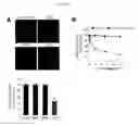 Fig. 07 - METHODS AND COMPOSITIONS FOR TREATING NEURONAL DAMAGE OR DEGENERATION