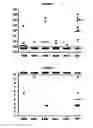Fig. 02 - Combinations of pneumococcal RrgB clades