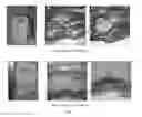 Fig. 10 - Silk Fibroin Hydrogels and Uses Thereof