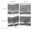 Fig. 11 - Silk Fibroin Hydrogels and Uses Thereof