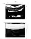 Fig. 05 - COATING STRUCTURE AND SURFACE PROCESSING METHOD