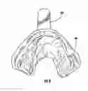 Fig. 07 - Orthodontic Repositioning Applicance