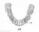 Fig. 09 - Orthodontic Repositioning Applicance