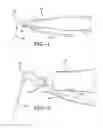 Fig. 02 - ULTRASONIC TIP FOR DENTAL DEVICE