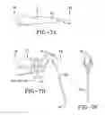 Fig. 09 - ULTRASONIC TIP FOR DENTAL DEVICE