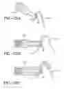 Fig. 20 - ULTRASONIC TIP FOR DENTAL DEVICE