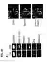 Fig. 53 - Use of regulatory sequences for specific, transient expression in neuronal determined cells
