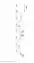 Fig. 02 - Method for detecting cancer cell caused by HPV, method for determining whether or not tissue is at stage of high-grade dysplasia or more severe stage, and primer set and kit used therefor