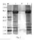 Fig. 02 - Process for differential polypeptides detection and uses thereof