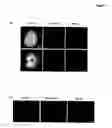 Fig. 02 - CENTROSOME AMPLIFICATION AS A BIOSENSOR FOR DNA DAMAGE