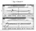 Fig. 08 - DNA MICROARRAY BASED IDENTIFICATION AND MAPPING OF BALANCED TRANSLOCATION BREAKPOINTS