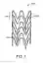 Fig. 02 - Method to make poly(L-lactide) stent with tunable degradation rate