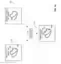 Fig. 02 - Method for producing an electrophysiological map of the heart