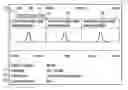 Fig. 01 - DYNAMIC PLANNING TOOL FOR USE IN CONTRAST-ENHANCED DYNAMIC SCAN IN MAGNETIC RESONANCE IMAGING