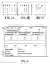 Fig. 02 - DYNAMIC PLANNING TOOL FOR USE IN CONTRAST-ENHANCED DYNAMIC SCAN IN MAGNETIC RESONANCE IMAGING