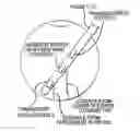Fig. 01 - Methods and apparatus for intraocular brachytherapy