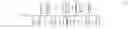 Fig. 02 - Blending cardiac rhythm detection processes