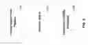 Fig. 04 - INCENTIVE AUDIO FOR PULMONARY FUNCTION DIAGNOSTICS