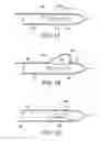 Fig. 02 - EXCISIONAL BIOPSY DEVICES AND METHODS