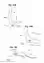 Fig. 09 - Devices and methods for minimally invasive access to sinuses and treatment of sinusitis