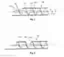 Fig. 02 - Method and device for tissue removal and for delivery of a therapeutic agent or bulking agent