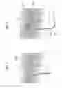 Fig. 03 - DILATION CATHETER