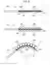 Fig. 05 - DILATION CATHETER