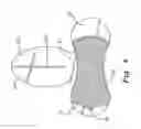 Fig. 03 - Catheter securement device