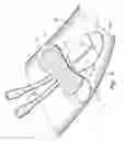 Fig. 04 - Catheter securement device