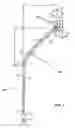 Fig. 02 - Patent foramen ovale catheter and method of using the same