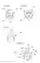 Fig. 22 - Method and apparatus for delivering a therapeutic substance through an injection port