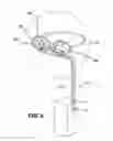 Fig. 03 - Method and apparatus for treating meibomian gland dysfunction employing fluid jet