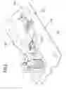 Fig. 09 - Multilayer absorbent article