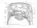 Fig. 01 - LIQUID HOLDING INTERFACE DEVICE FOR OPHTHALMIC LASER PROCEDURES