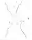 Fig. 02 - Systems and methods for sternum repair