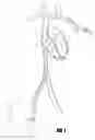 Fig. 02 - APPARATUS AND METHODS FOR TRANSFERRING AN IMPLANTED ELONGATE BODY TO A REMOTE SITE