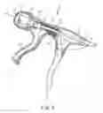 Fig. 03 - Suturing system and assembly