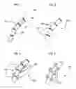 Fig. 02 - Bioerodible self-deployable intragastric implants