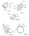 Fig. 08 - Bioerodible self-deployable intragastric implants