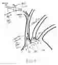 Fig. 07 - Dual endovascular filter and methods of use
